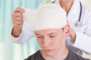 How Workman Car Accident & Personal Injury Lawyers Can Help After a Brain Injury in Clermont, FL